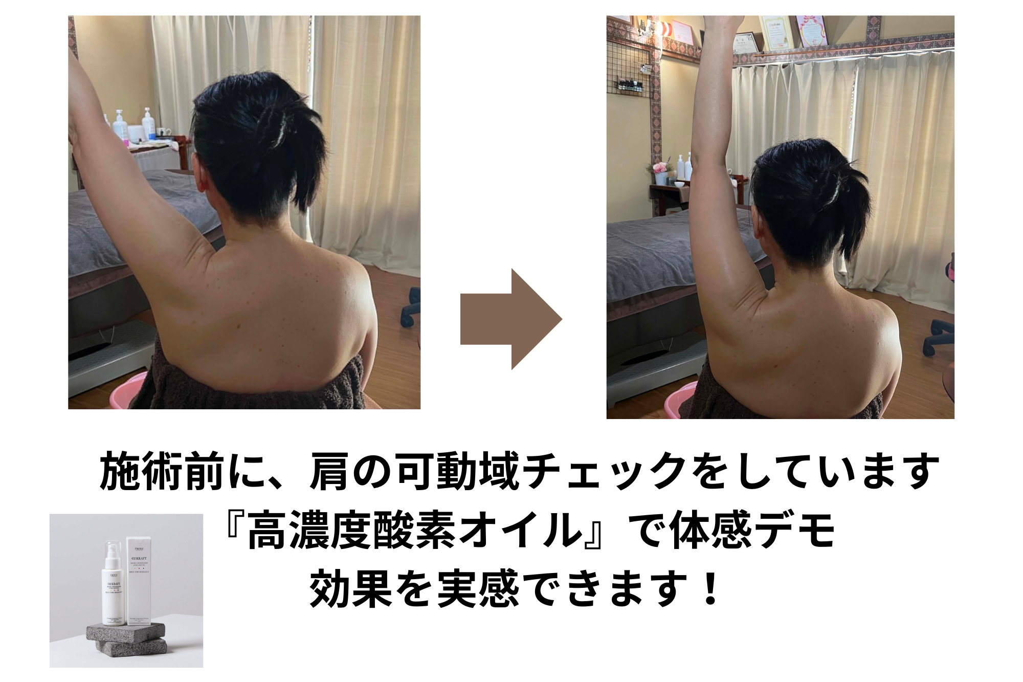 梅雨の時期、首肩の重だるさを感じていませんか？
